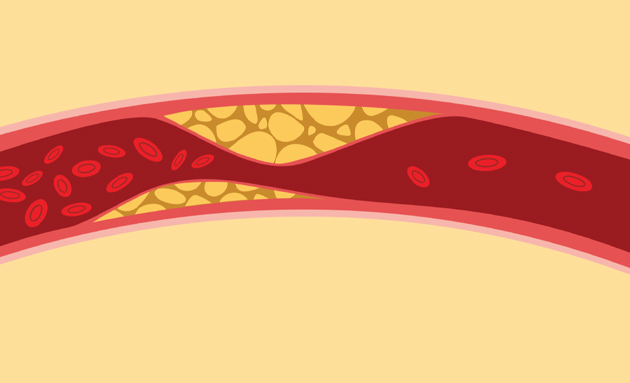 Cholesterol